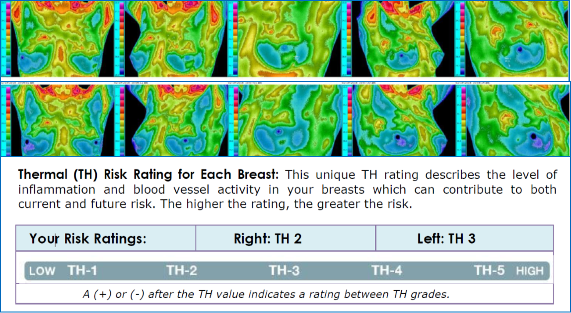 Understanding Your Thermal Breast Imaging Scan