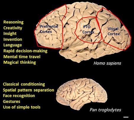 Superior pattern processing in the brain